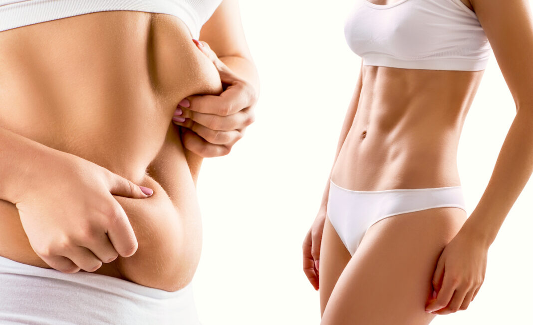 Introduction to Body Sculpting: Reshaping Your Body with Non-Surgical Procedures